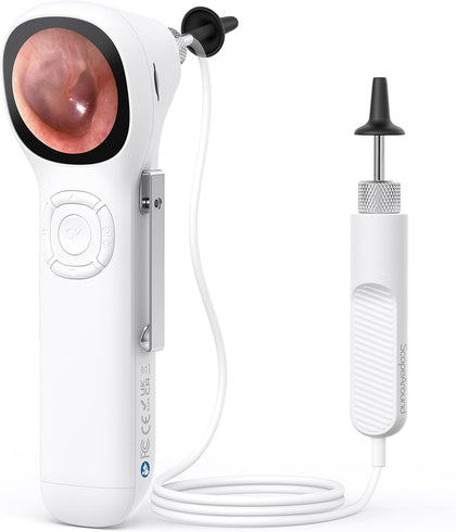 Otoscope with Light, No App Needed, HD Screen, Ear Scope Camera for Family | Ear Camera with Earwax Removal Kit for