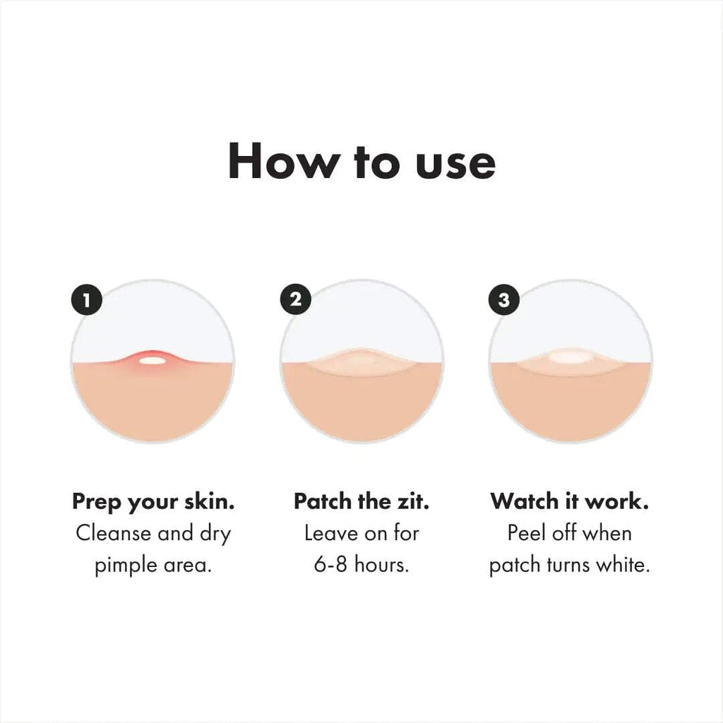 Hero Cosmetics Variety Pack of Acne Pimple Patches, 26 Ct | Includes Original, Invisible+, XL Surface Patches;