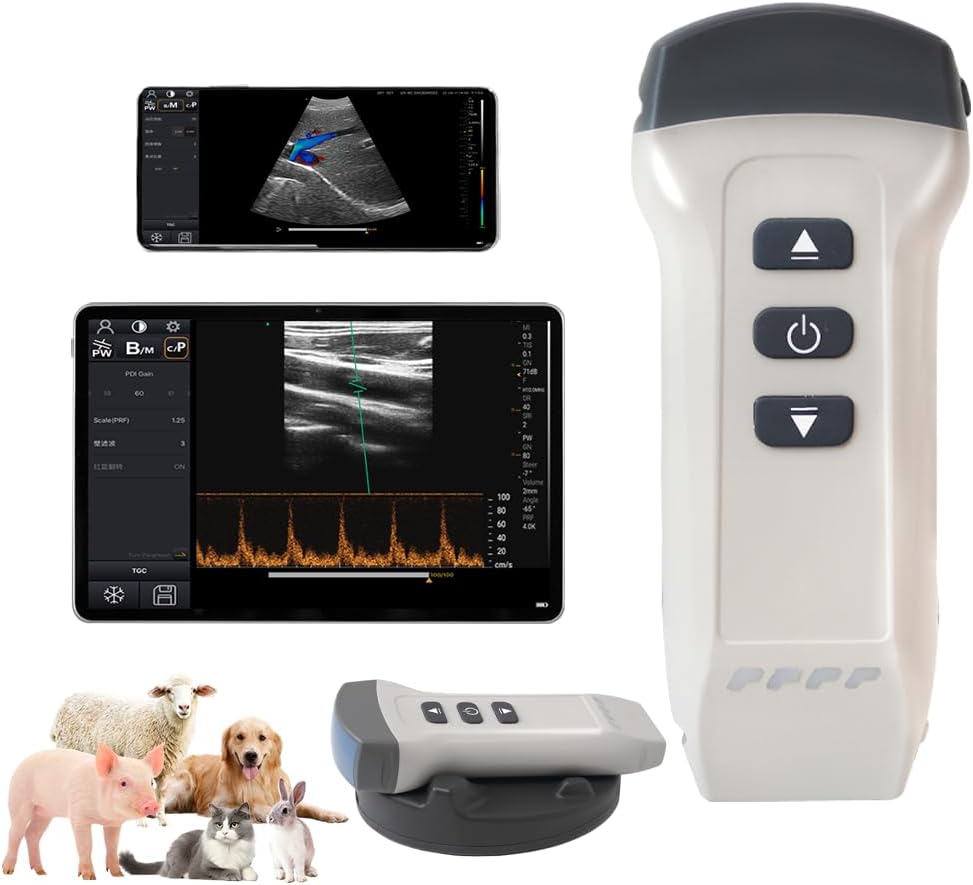 Dual Probe Wireless Color Doppler Ultrasound Machine 3.2MHZ and 7.5MHZ Probe, Wireless Ultrasound Machine for Android