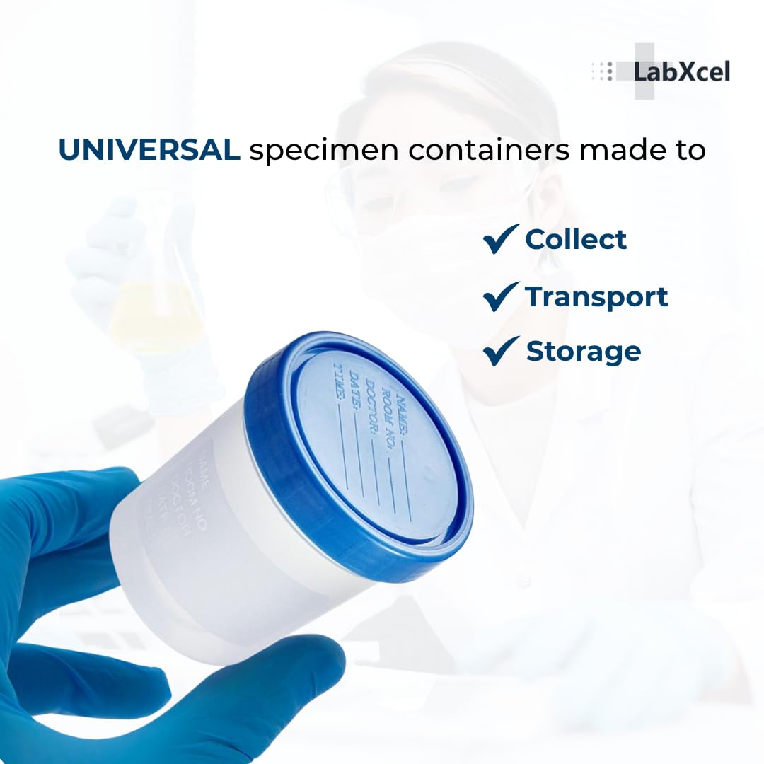 Polypropylene Clear Specimen Containers with Screw Cap – 4.5oz (120mL) Sample Collection Cups for Urine, Stool &