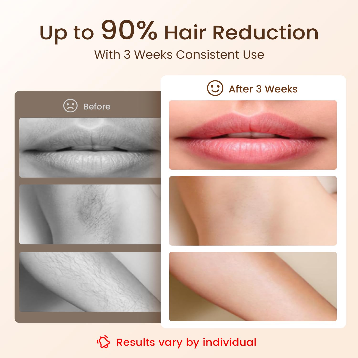 Laser Hair Removal LIJAI IPL Hair Removal Device for Women & Men | 999,999 Flashes Painless Long-Lasting Results, at