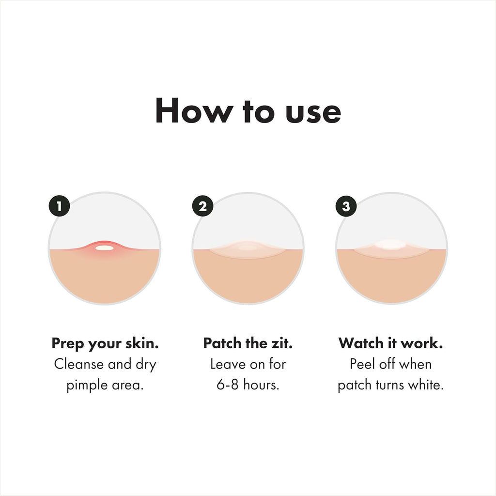 Hero Cosmetics Mighty Patch Surface Large Acne Pimple Patches, 10 Ct | Multi-Blemish Acne Spot Patch; For Cheek