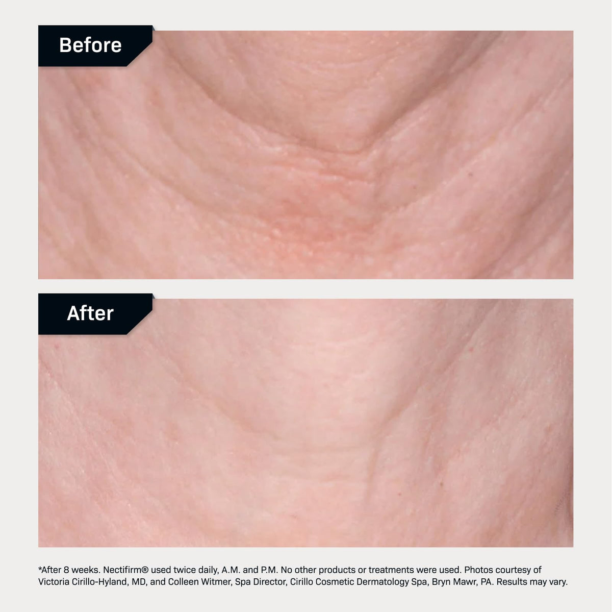 Nectifirm Neck Firming Cream