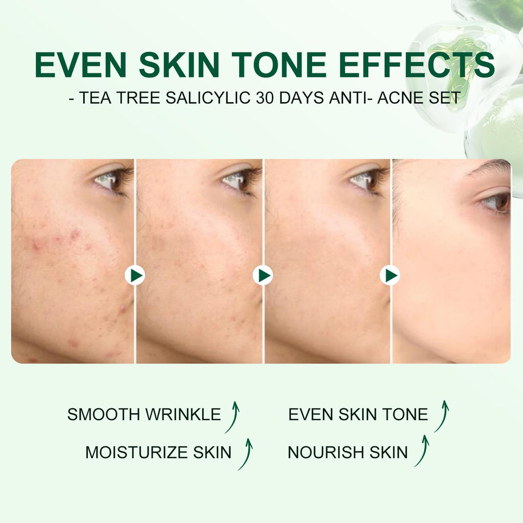 Tea Tree Salicylic Acid Facial Skin Care Set, Acne Treatment Skincare Set ,Skincare Mini Kit, Facial Kit Gifts for