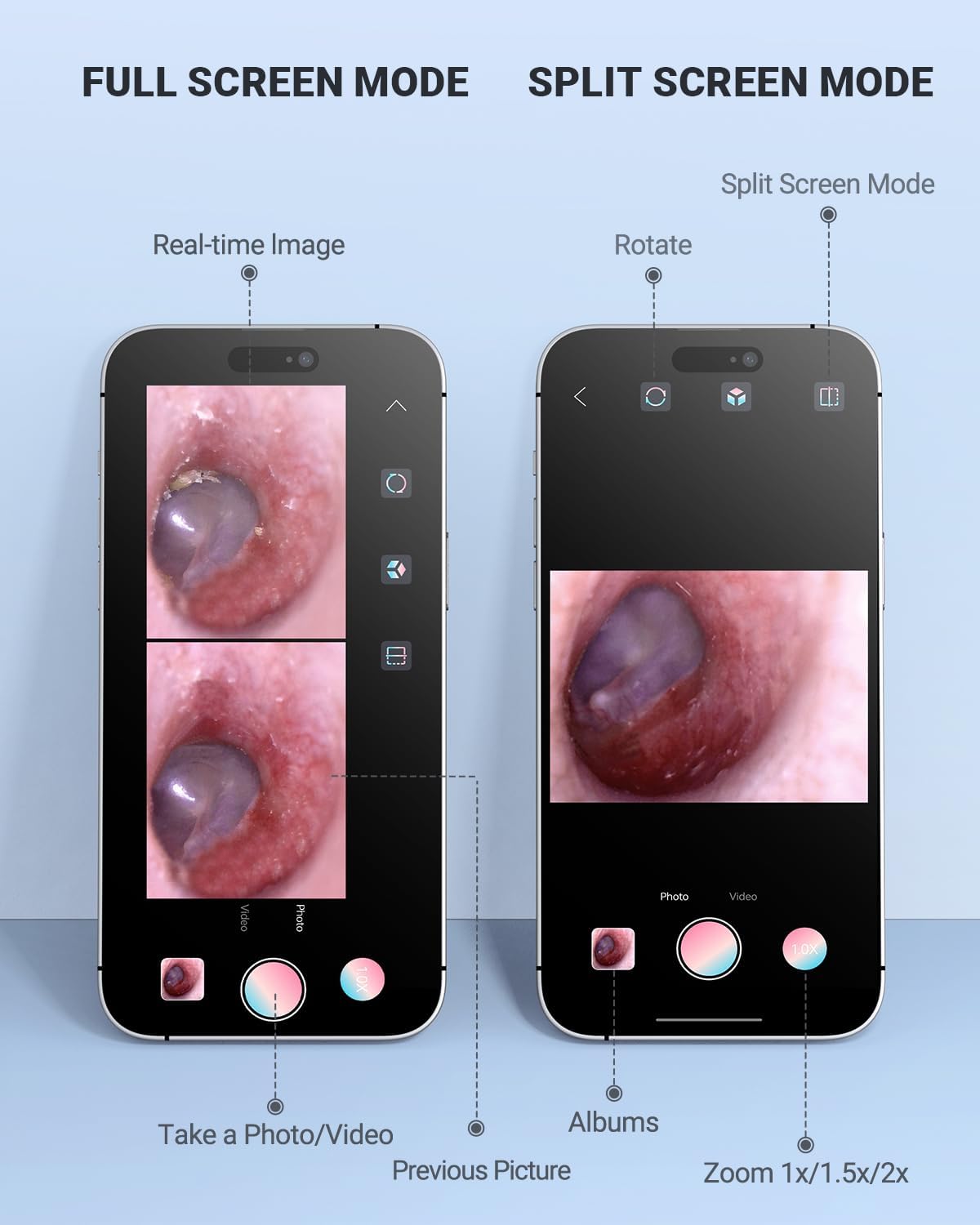 Digital Otoscope Compatible with Android Devices, Ear Camera with Ear Wax Removal Tools, Video Ear Scope Otoscope