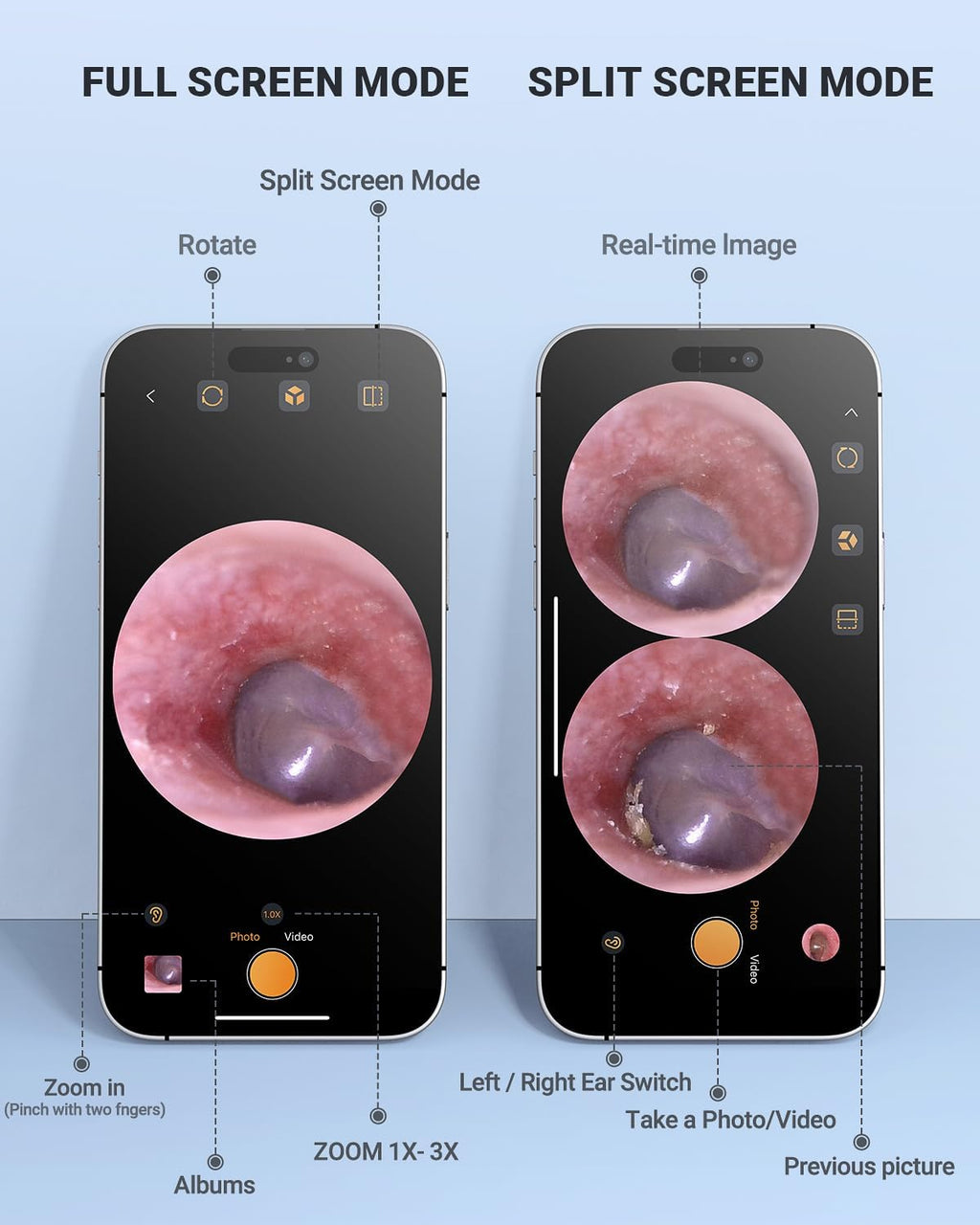 Digital Otoscope Compatible with iPhone & Android, Video Ear Scope Camera