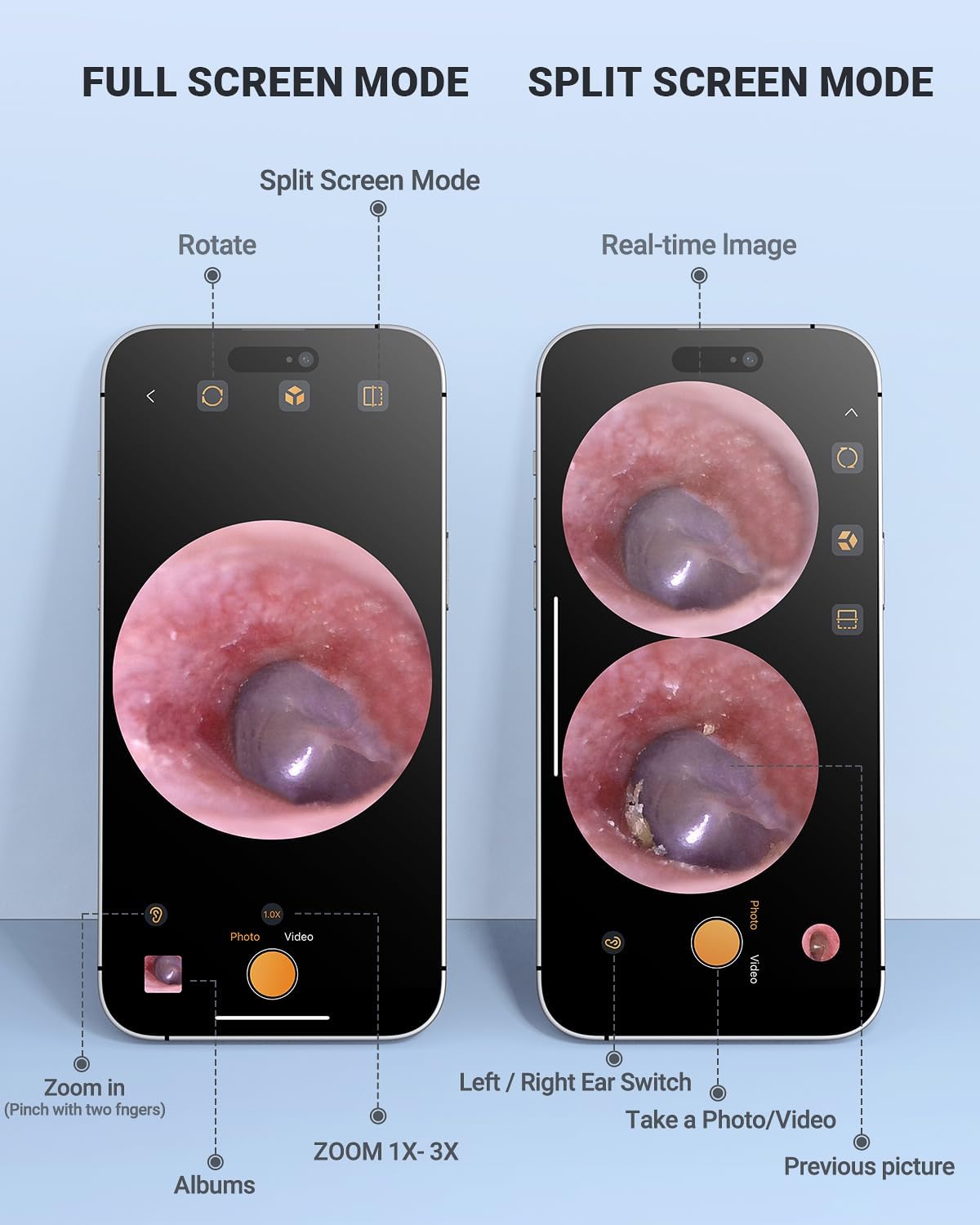 Digital Otoscope Compatible with iPhone & Android, Video Ear Scope Camera