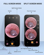 Digital Otoscope, Video Ear Scope Camera Compatible with iPhone/Android