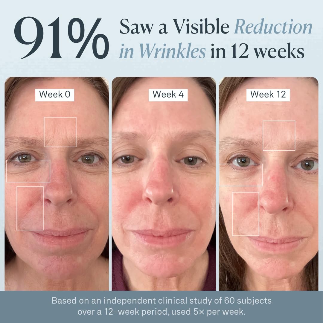 LuminX Pro LED Face Mask Light Therapy with Chin & Lip Coverage | Deep NIR