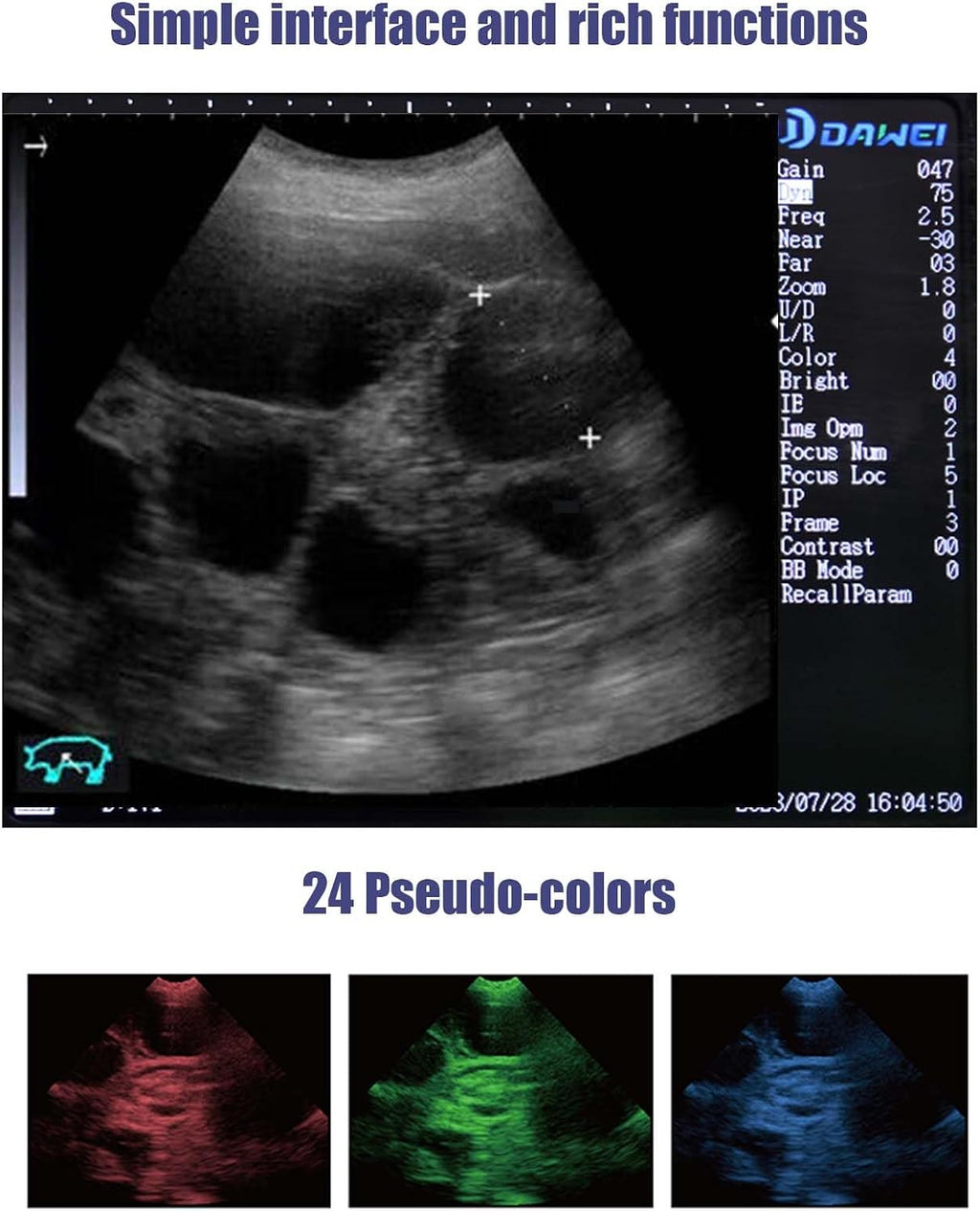 S1 Veterinary Ultrasound Machine for Pregnancy Portable Vet Handheld Scanner B-Ultra Sound with 3.5Mhz Convex Probe