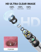 WiFi Otoscope Gyroscope, Ear Scope Camera Compatible with iPhone/Android
