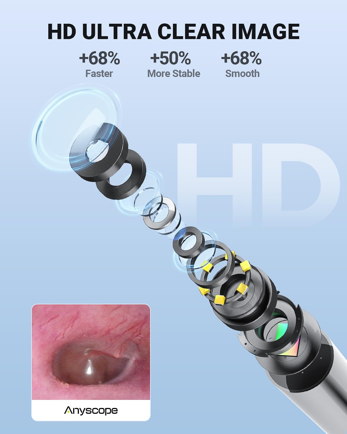 WiFi Otoscope Gyroscope, Ear Scope Camera Compatible with iPhone/Android