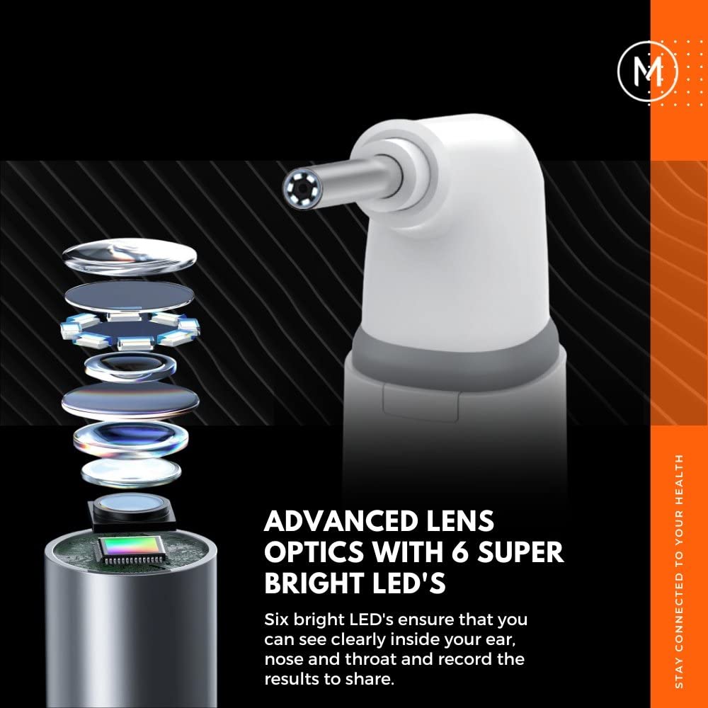 Smart Otoscope for Ears, Nose & Throat, 1080P HD Ear Camera with App for Adults & Kids, Rechargeable Digital Otoscope