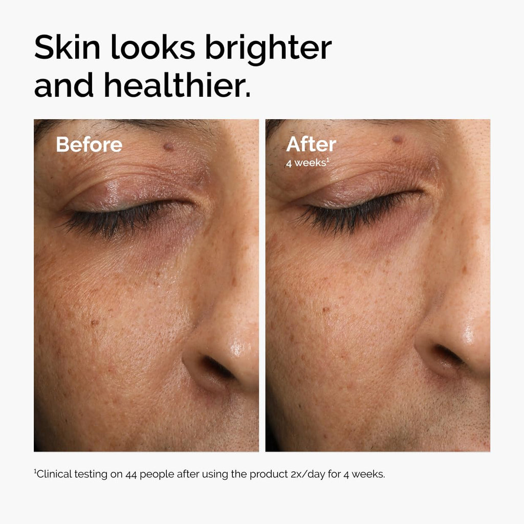 Multi-Antioxidant Radiance Serum, Vitamin C Serum For Face, Brighten & Protect Skin – Boosts Glow & Shields Against