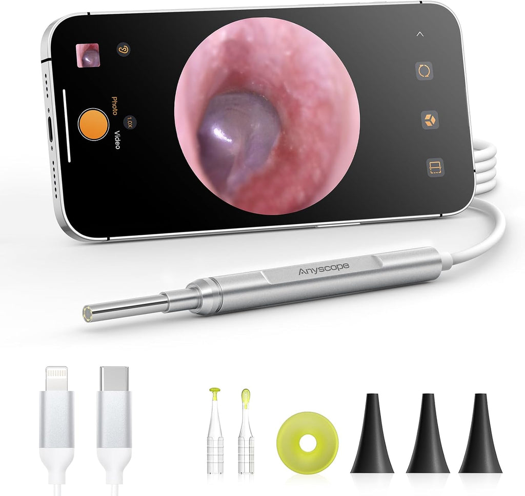 Digital Otoscope Compatible with iPhone & Android, Video Ear Scope Camera