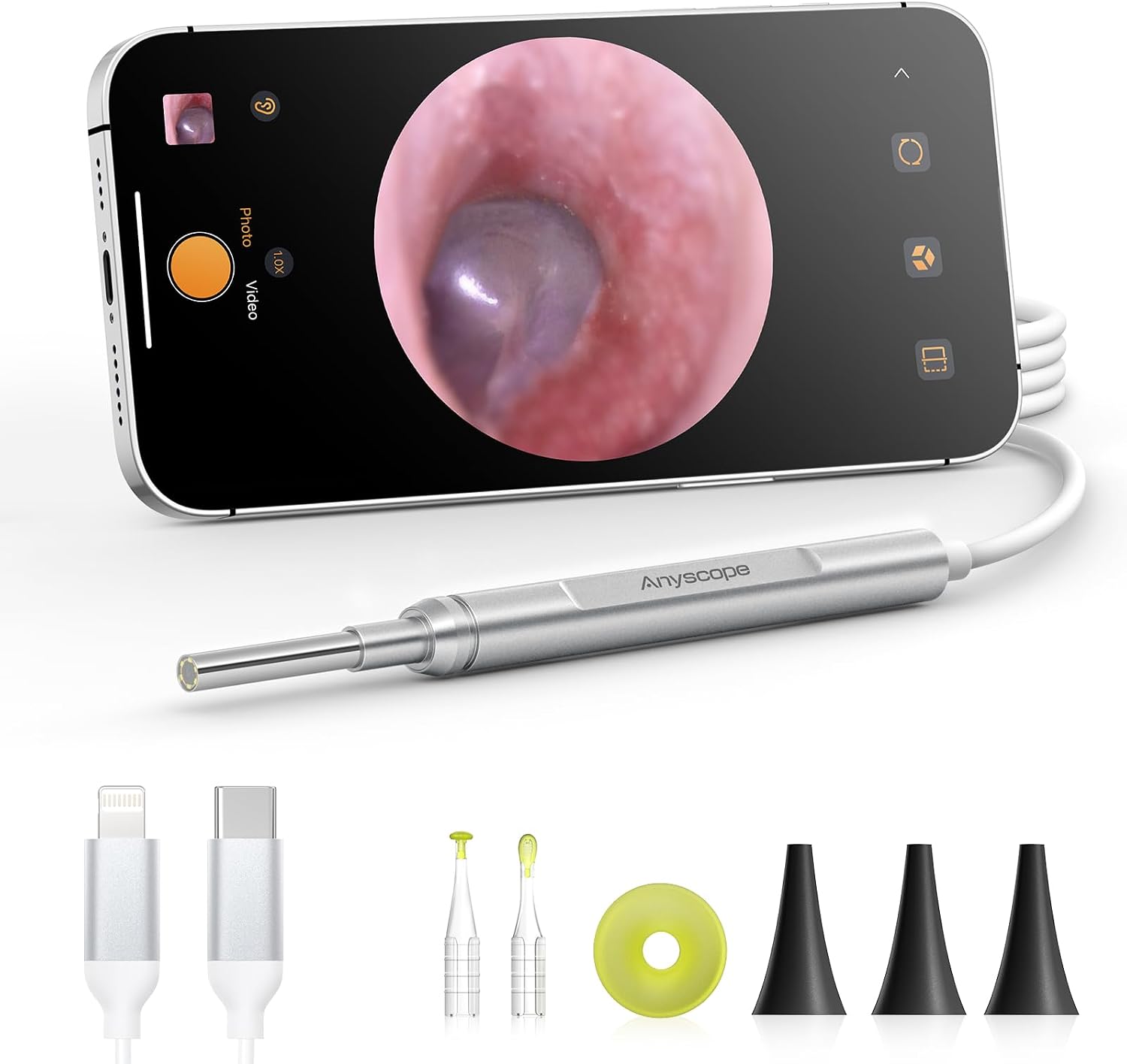 Digital Otoscope Compatible with iPhone & Android, Video Ear Scope Camera