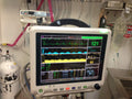 Utech PM5000VP Veterinary Multi-parameters Monitor with SPO2, NIBP,Temp,ECG,PR,Resp, Printer