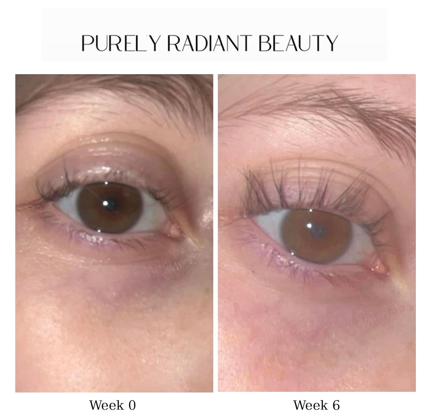 Beauty Eyelash Growth Serum – Prostaglandin-Free Lash & Brow Enhancer for Longer, Thicker Lashes – Vegan