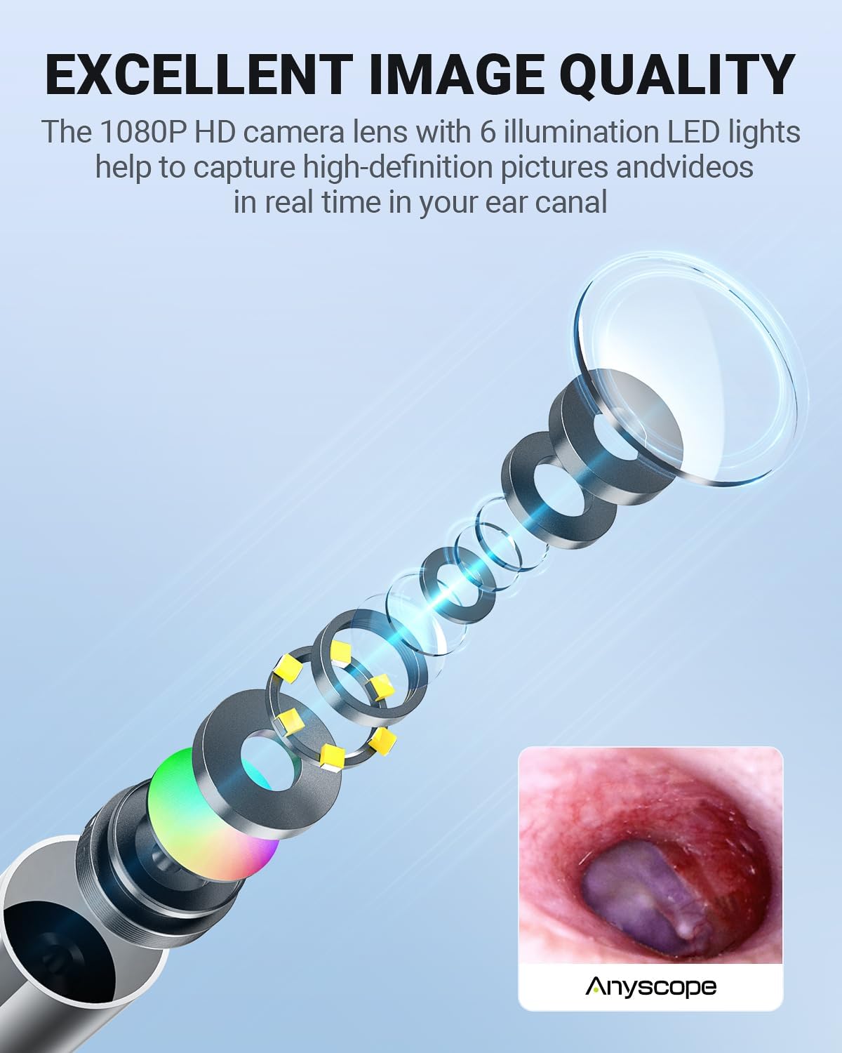 Otoscope with Gyroscope, Ear Scope Camera, Compatible with iPhone/Android