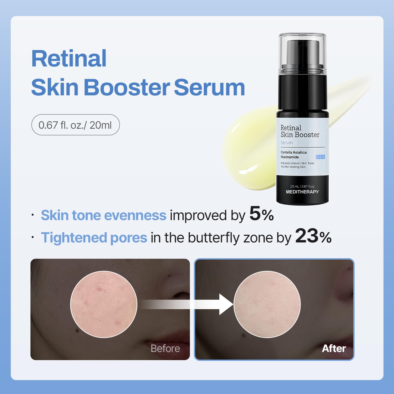 Gentle Boost Kit – Korean Skin Care Set with Retinal & Hyaluronic Acid Serum & Squalane Moisturizer, Anti-Aging &