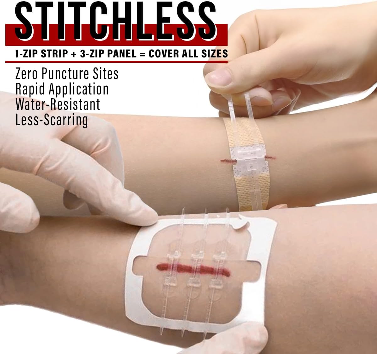Wound Closure Kit | Surgical Zip-Stitch Devices for Cut & Laceration | Sterile, Suture-Free, Stitch-Less Adhesive