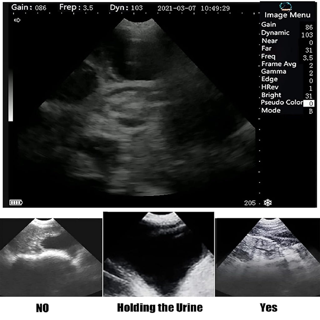 Dog Pregnancy Test Ultrasound Scanner Veterinary Machine Laptop 12 Inch Portable Black White Doppler Farm Animals