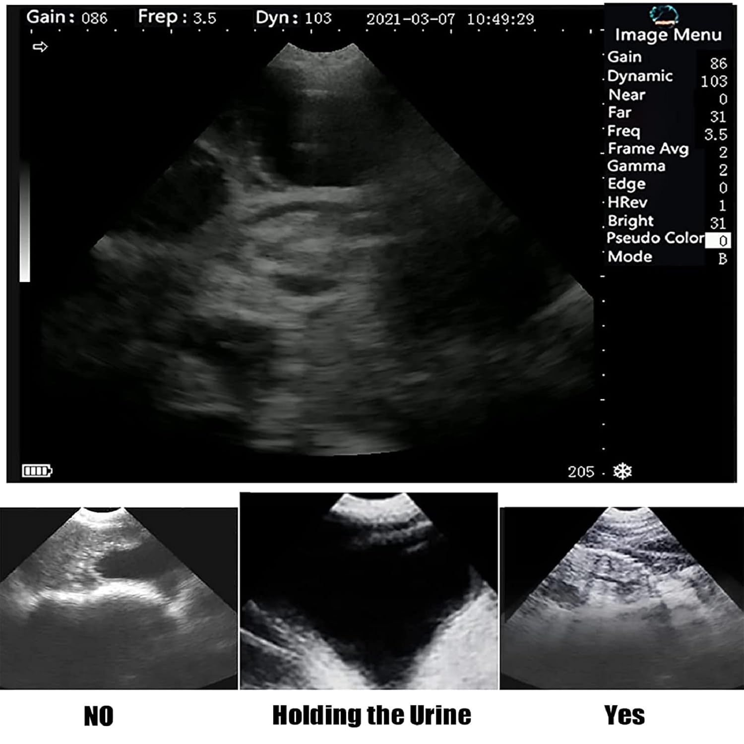 Dog Pregnancy Test Ultrasound Scanner Veterinary Machine Laptop 12 Inch Portable Black White Doppler Farm Animals