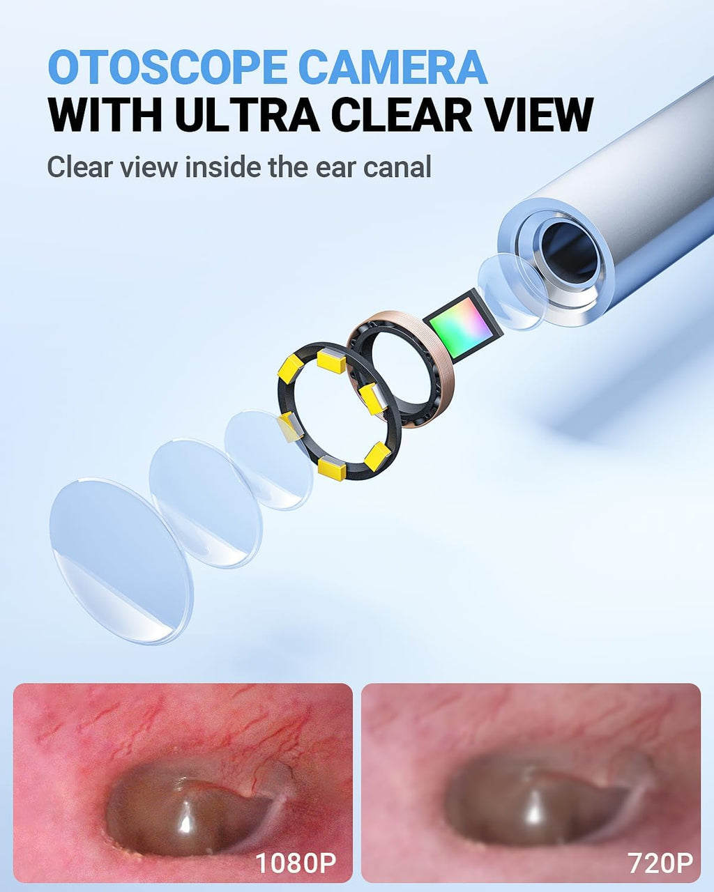 Otoscope with 4.5" IPS Screen, 3.9mm Ear Camera with Gyroscope