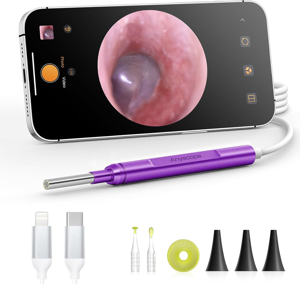 Digital Otoscope Compatible with iPhone & Android, Video Ear Scope Camera