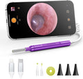 Digital Otoscope Compatible with iPhone & Android, Video Ear Scope Camera