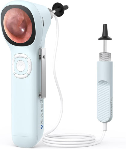 Otoscope with Light, No App Needed, HD Screen, Ear Scope Camera for Family