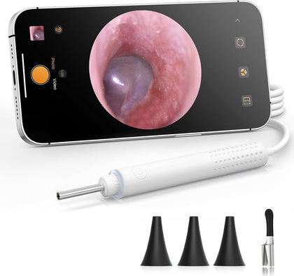 Otoscope Camera with Light 720P HD, USB-C Ear Camera, Plug & Play Ear Scope