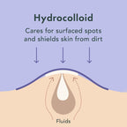 Miracle Spot Control Cover Hydrocolloid Strips Pimple Patches (20 Ct)