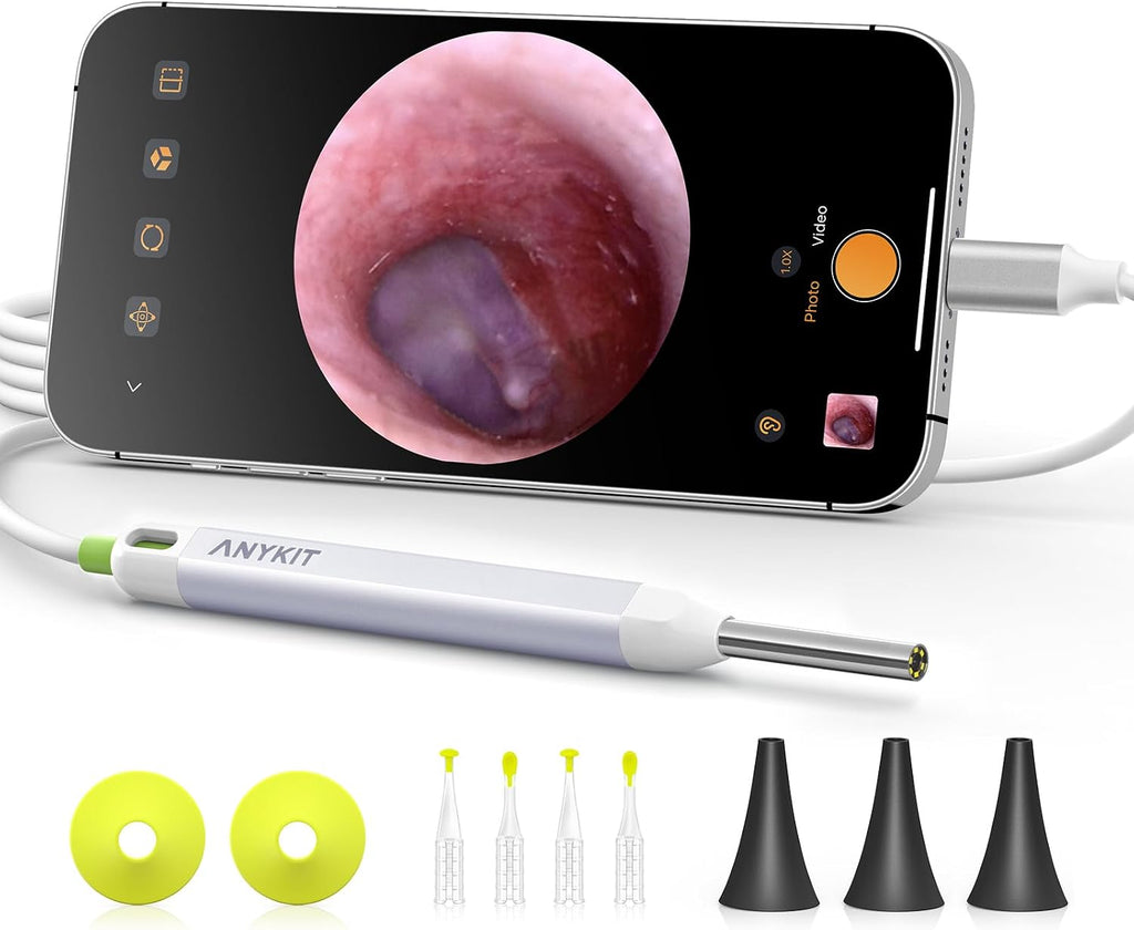 Digital Otoscope with Gyroscope, HD Ultra Clear View Ear Camera with Ear Wax Removal Tools, Video Ear Scope Otoscope