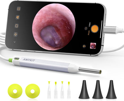 Digital Otoscope with Gyroscope, HD Ultra Clear View Ear Camera with Ear Wax Removal Tools, Video Ear Scope Otoscope