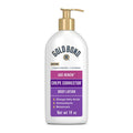 Age Renew Crepe Corrector Body Lotion, 14 Oz
