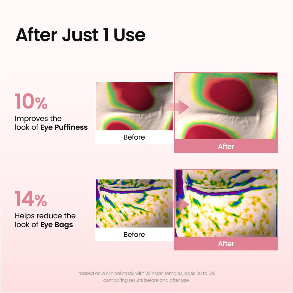 Collagen Peptide Eye Patches, Anti Wrinkle & Smile Line Patches for Face, Under Eye Mask for Fine Lines & Eye Bags