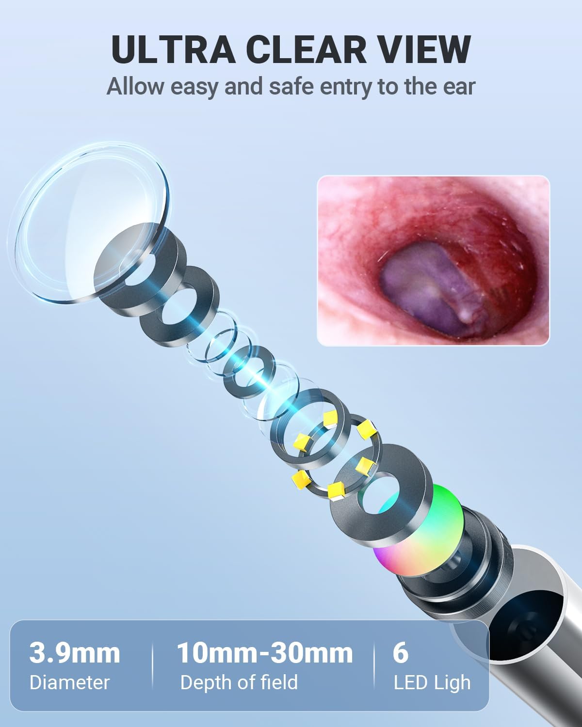 Digital Otoscope with Gyroscope, 4.5 Inches Screen, 3.9mm Ear Scope Camera with 6 Lights, Ear Wax Removal Tool, 32GB