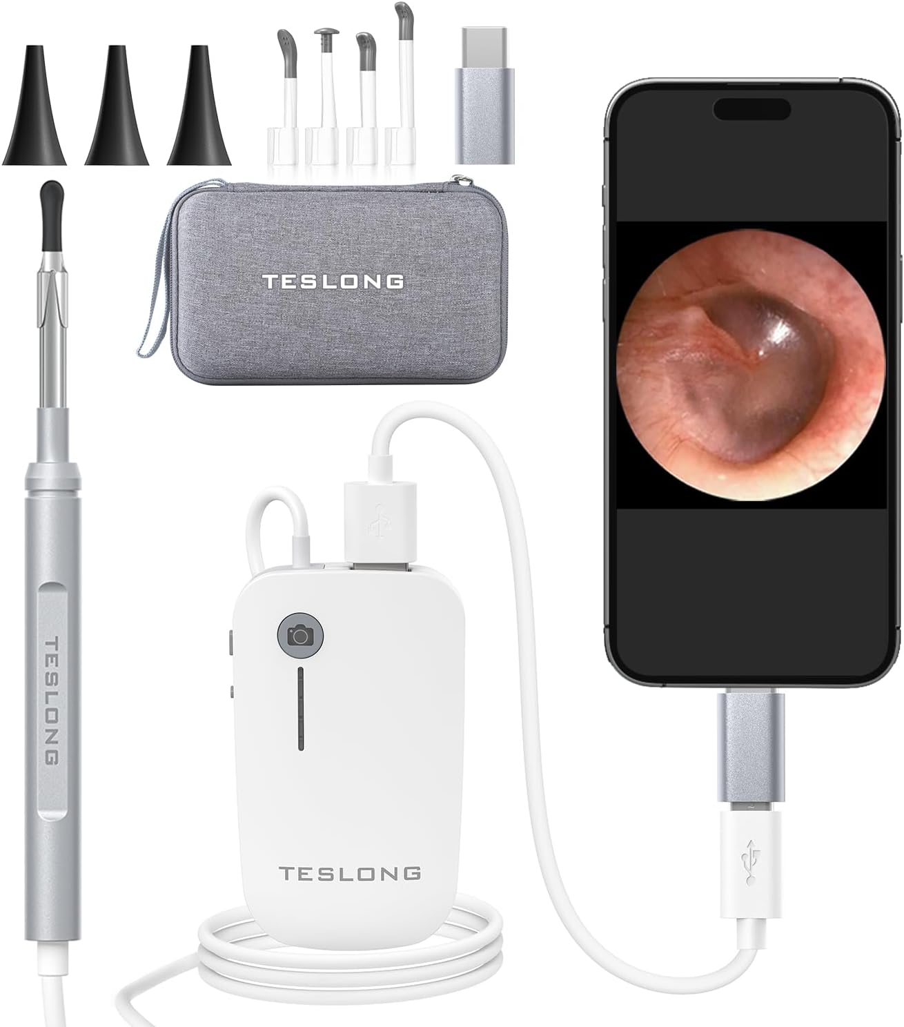 Digital Otoscope with Light 1080P Full HD Otoscope Camera for USB-C Devices