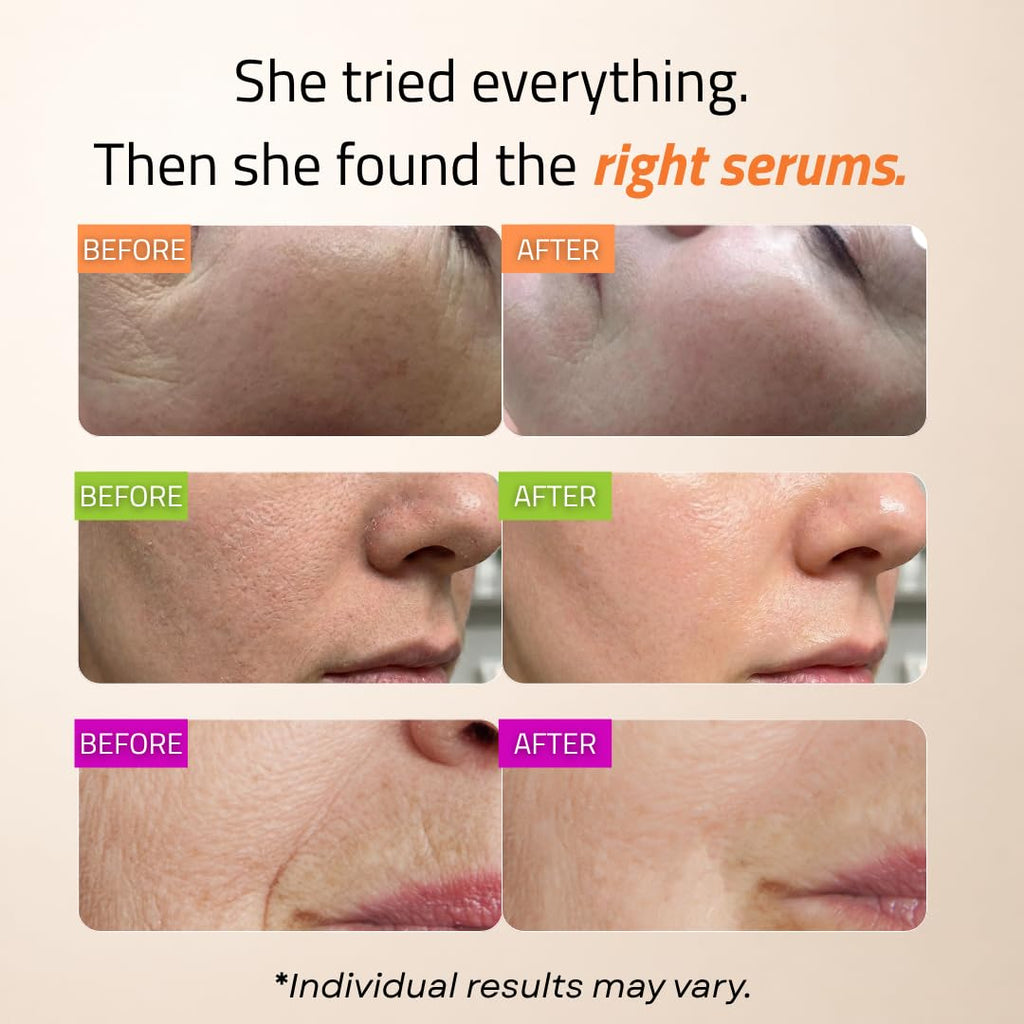 Skincare Set: Retinol, Vitamin C, and 99% Hyaluronic Acid Serum, Face Serum Set Targets Appearance of Uneven Skin and