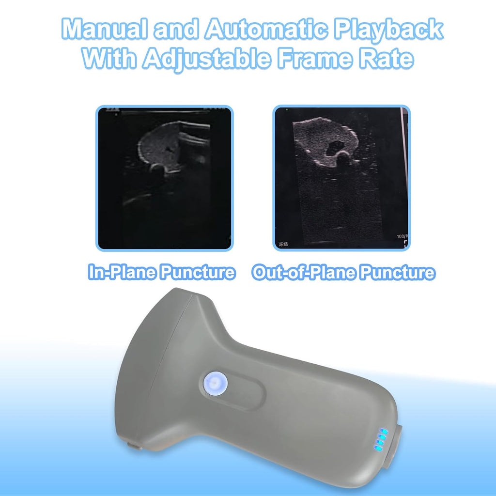 Wireless Convex Abdominal Ultrasound Probe - Handheld Portable Scanner & Medical Training Device for Clinical