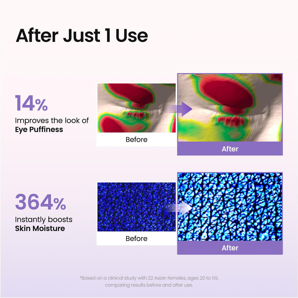 Caviar PDRN Eye Patches, Nourishing Under Eye Patches for Dark Circles, Depuffing Eye Mask for Puffy & Tired Eyes