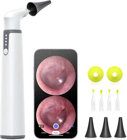 Wireless Otoscope with Gyroscope, 3.9mm Ear Scope Camera