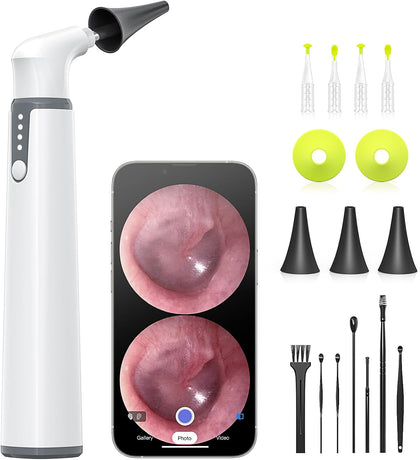 WiFi Otoscope Gyroscope, Ear Scope Camera Compatible with iPhone/Android