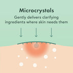 Miracle Microcrystal Spot Cover Hydrocolloid Pimple Patches (36 Ct)