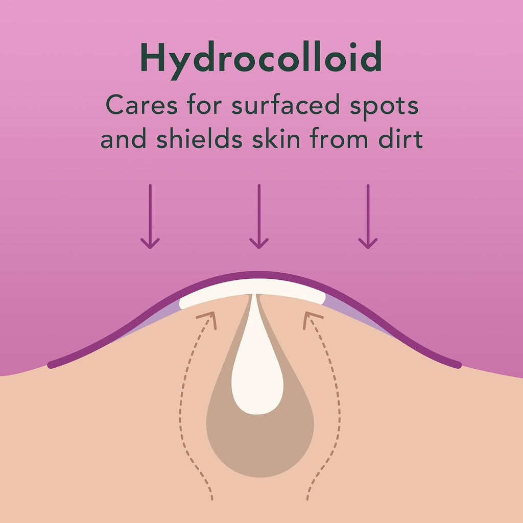 Miracle Overnight Spot Cover Hydrocolloid Acne Pimple Patches (104 Ct) | Thicker & Extra Adhesion, Ultra-Thin Patch