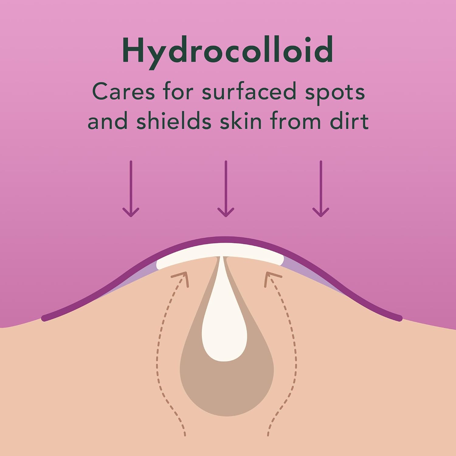 Miracle Overnight Spot Cover Hydrocolloid Acne Pimple Patches (104 Ct) | Thicker & Extra Adhesion, Ultra-Thin Patch