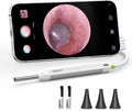 Digital Otoscope Compatible with Android Devices, Ear Camera with Ear Wax Removal Tools, Video Ear Scope Otoscope