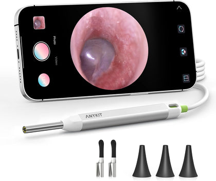 Digital Otoscope Compatible with Android Devices, Ear Camera with Ear Wax Removal Tools, Video Ear Scope Otoscope