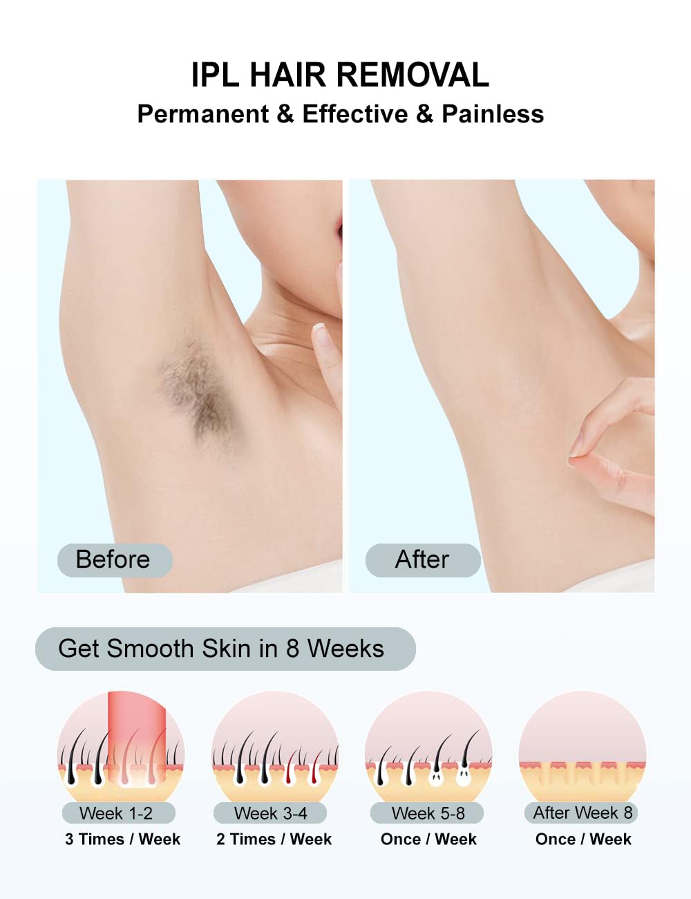 IPL Laser Hair Removal for Women and Men Permanent At-Home Lazer Facial Hair Epilator 999,999 Flashes Painless Hair